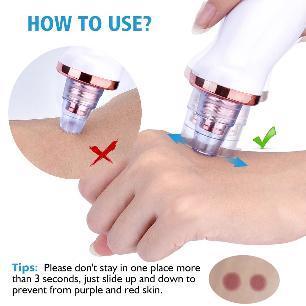5 in 1 Blackhead remover | Derma Suction  | Rechargeable | Free Gift Card 🎁