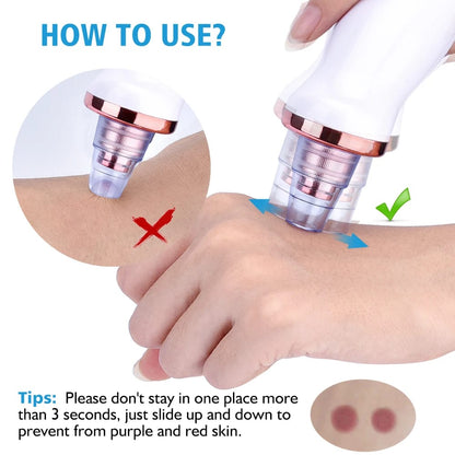 5 in 1 Blackhead remover | Derma Suction  | Rechargeable | Free Gift Card 🎁